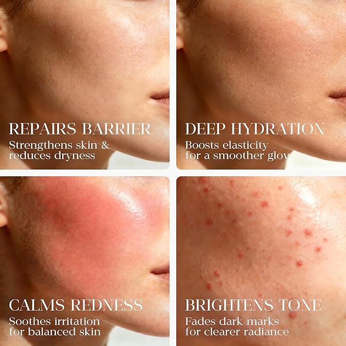 Organic Barrier Repair Face Oil | Deep Hydration & Redness Soothing | Firming & Brightening with Squalane, Niacinamide, Vitamin E & Camelina Seed Oil | Gua Sha Oil for Dry & Sensitive Skin